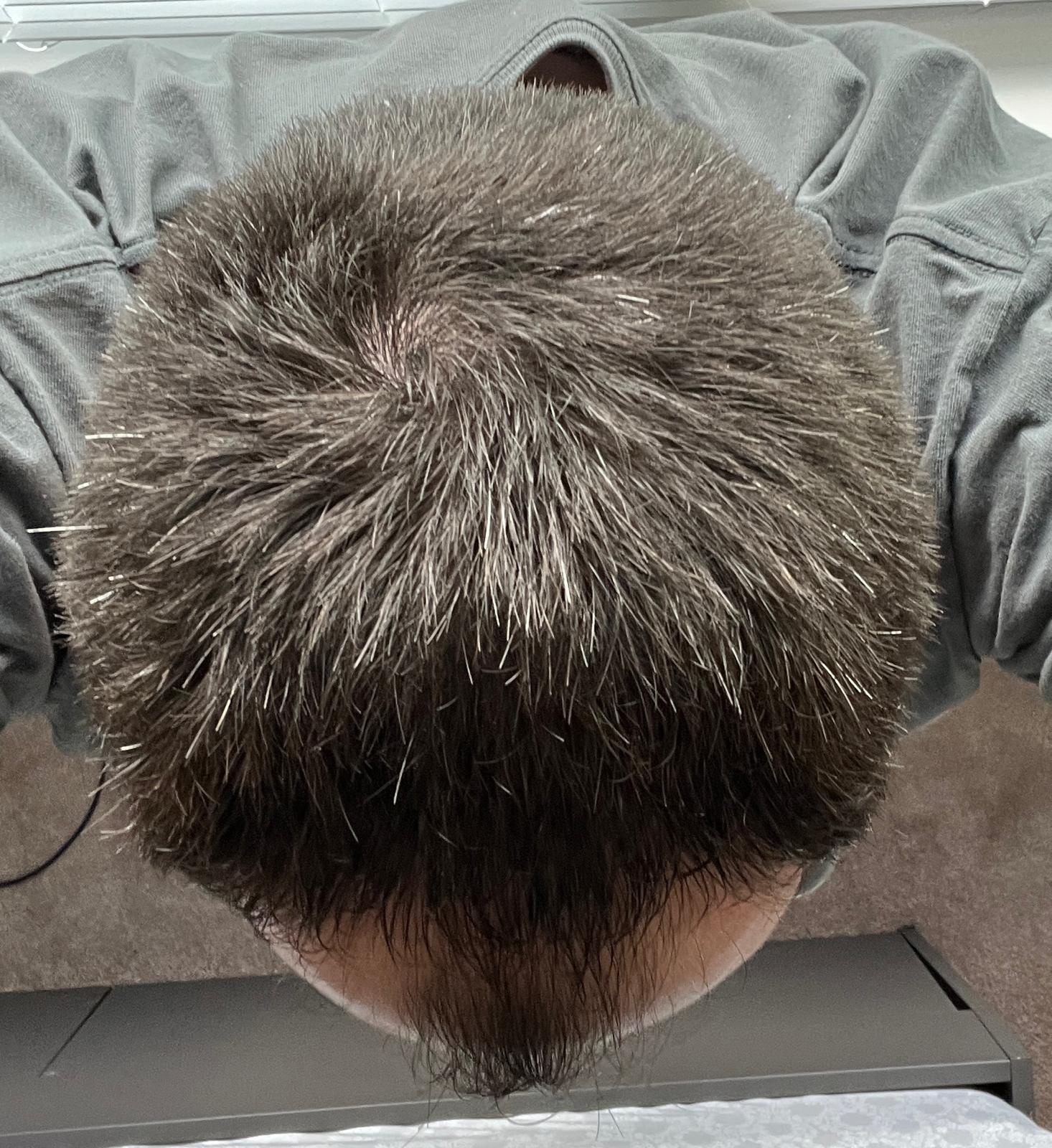 The crown of my head from above, hair damp with serum